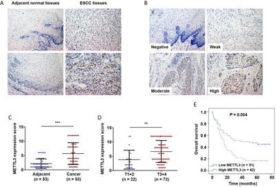 METTL3 Promotes Esophageal Squamous Cell Carcinoma Metastasis Through Enhancing GLS2 Expression